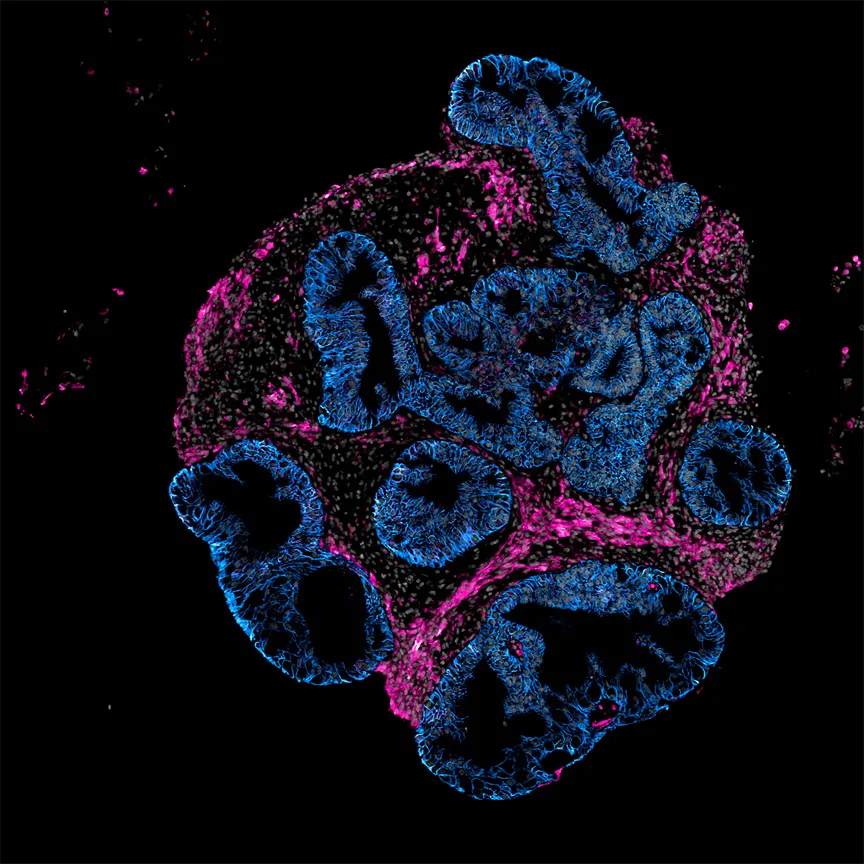The Future of Pharma: How Intero Biosystems is Mailing “Mini-Guts” to Revolutionize Drug Development